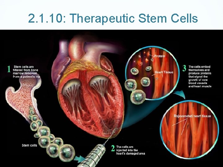 2. 1. 10: Therapeutic Stem Cells 