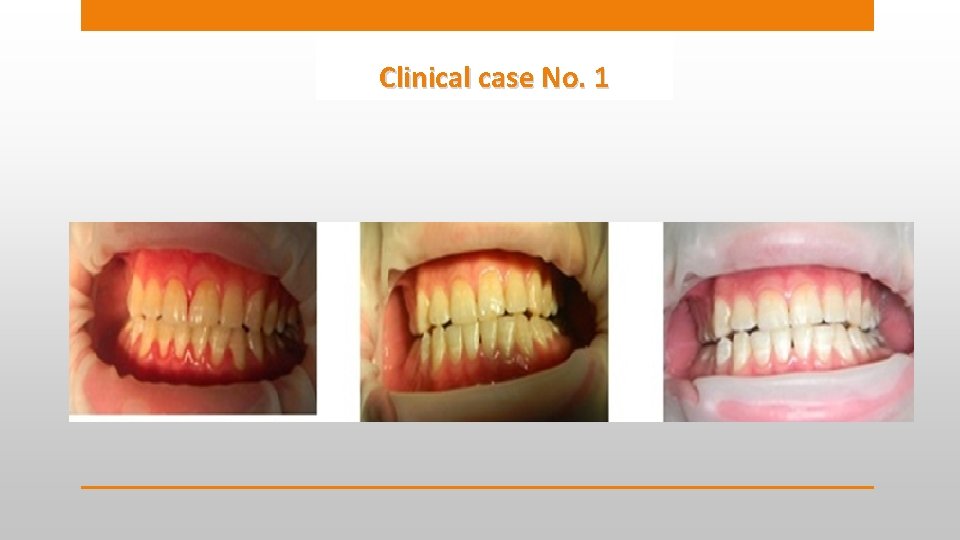 Clinical case No. 1 