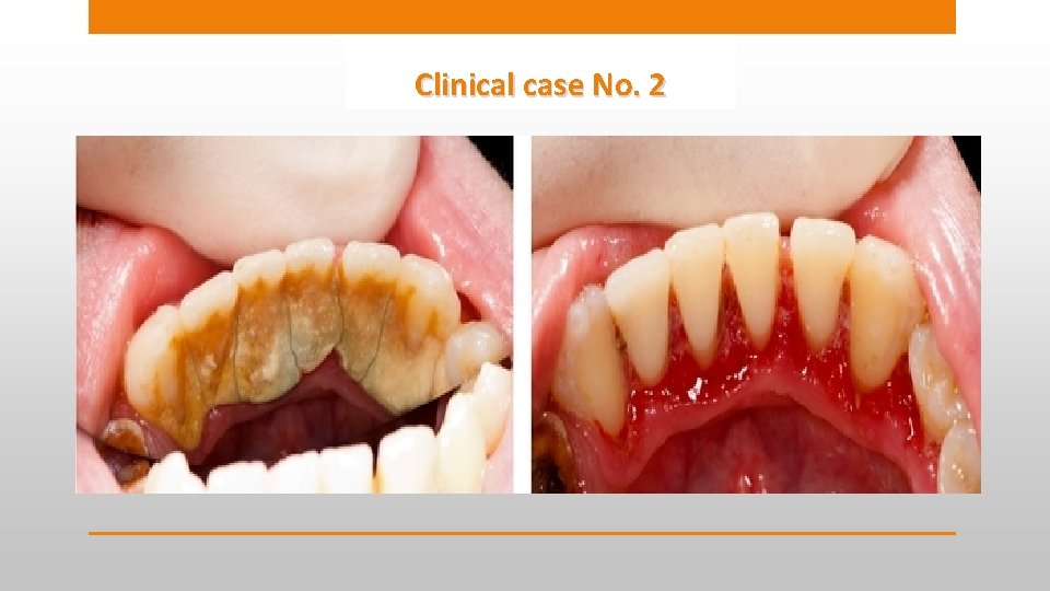 Clinical case No. 2 