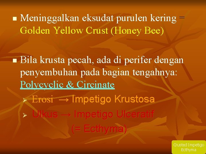 n n Meninggalkan eksudat purulen kering = Golden Yellow Crust (Honey Bee) Bila krusta