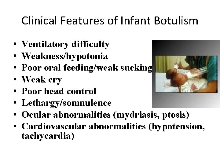 Clinical Features of Infant Botulism • • Ventilatory difficulty Weakness/hypotonia Poor oral feeding/weak sucking