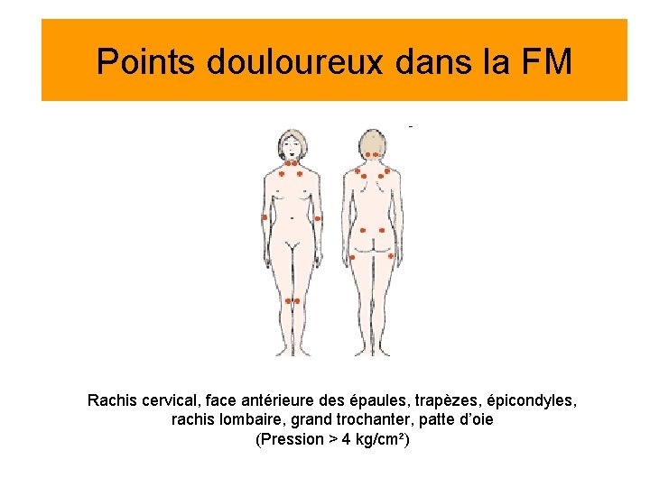 Points douloureux dans la FM Rachis cervical, face antérieure des épaules, trapèzes, épicondyles, rachis