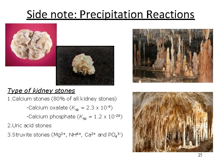 Side note: Precipitation Reactions Type of kidney stones 1. Calcium stones (80% of all