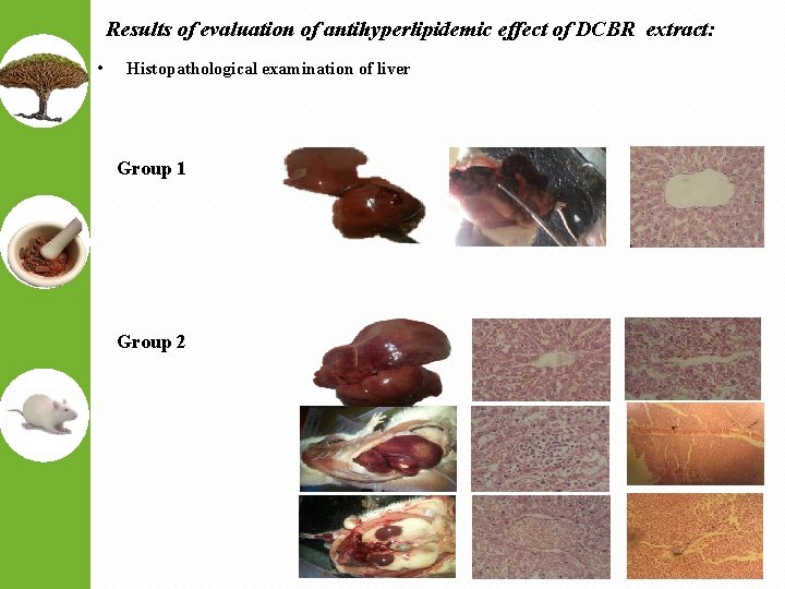 Results of evaluation of antihyperlipidemic effect of DCBR extract: • Histopathological examination of liver