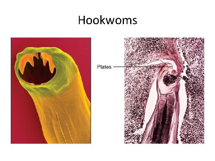 Hookwoms 