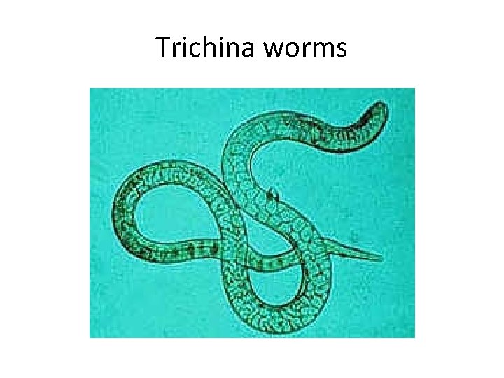 Trichina worms 