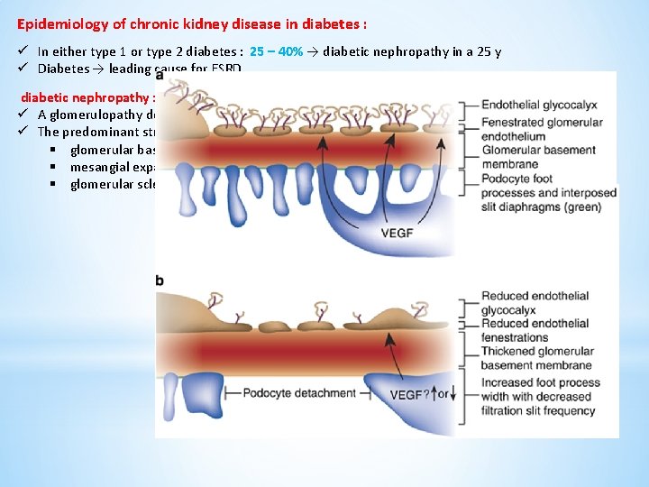 Epidemiology of chronic kidney disease in diabetes : ü In either type 1 or