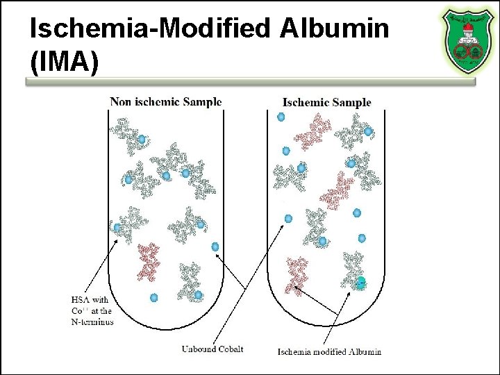 Ischemia-Modified Albumin (IMA) Ischemia-Modified Albumin (IMA)