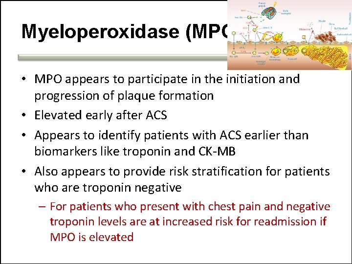 Myeloperoxidase (MPO) • MPO appears to participate in the initiation and progression of plaque Myeloperoxidase (MPO) • MPO appears to participate in the initiation and progression of plaque