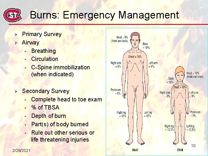Burns: Emergency Management Ø Ø Ø Primary Survey Airway • Breathing • Circulation •