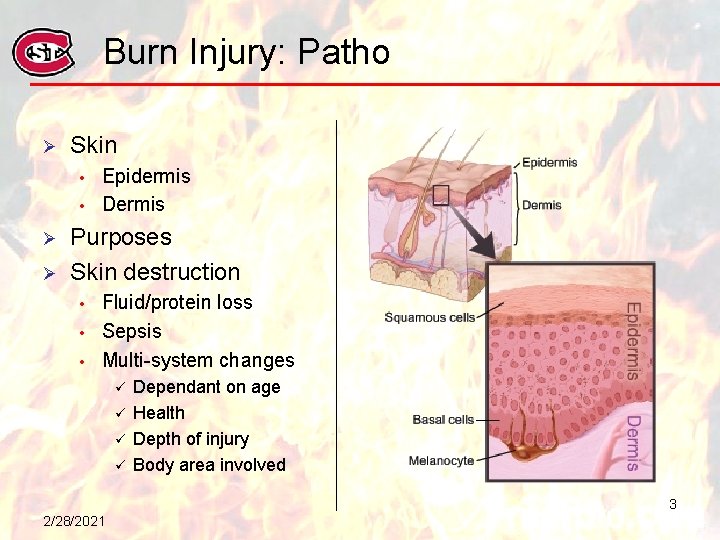Burn Injury: Patho Ø Skin • • Ø Ø Epidermis Dermis Purposes Skin destruction