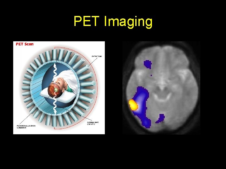 PET Imaging 