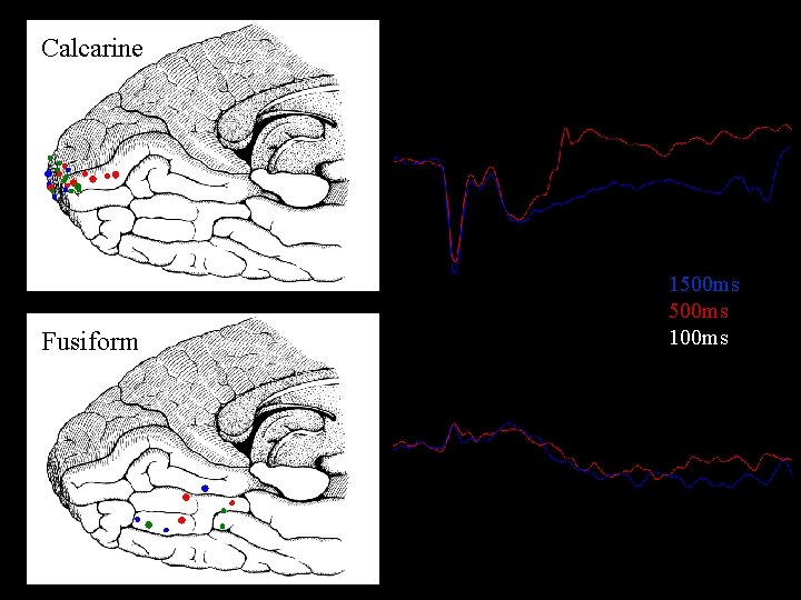 Calcarine 1500 ms 100 ms Fusiform * 