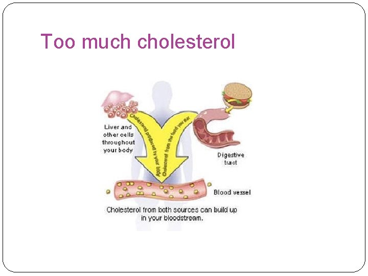 Too much cholesterol 