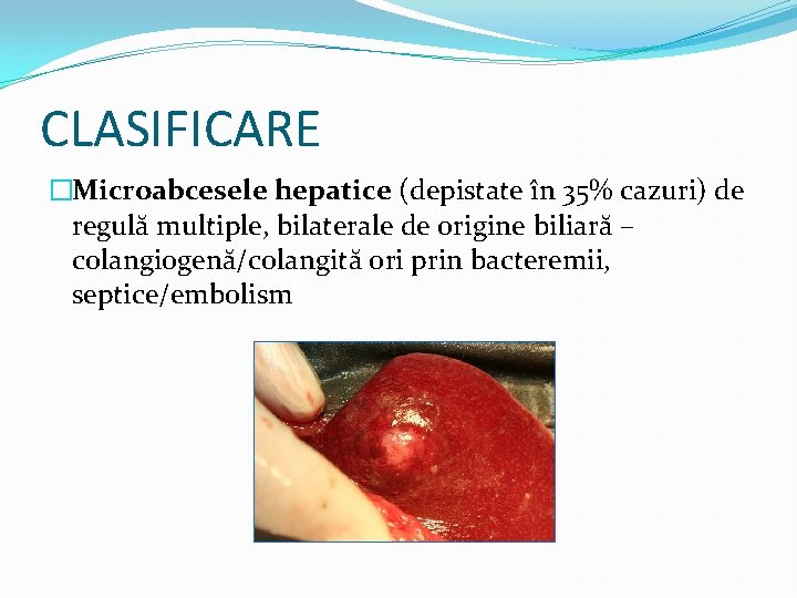 CLASIFICARE �Microabcesele hepatice (depistate în 35% cazuri) de regulă multiple, bilaterale de origine biliară