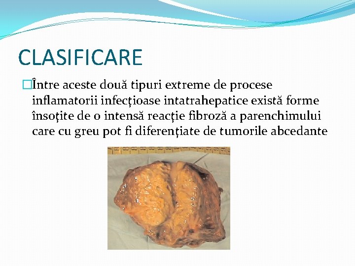 CLASIFICARE �Între aceste două tipuri extreme de procese inflamatorii infecţioase intatrahepatice există forme însoţite