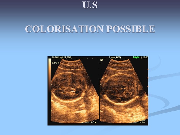 U. S COLORISATION POSSIBLE U. S COLORISATION POSSIBLE