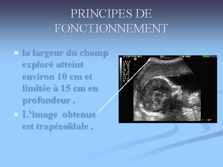 PRINCIPES DE FONCTIONNEMENT la largeur du champ exploré atteint environ 10 cm et limitée PRINCIPES DE FONCTIONNEMENT la largeur du champ exploré atteint environ 10 cm et limitée