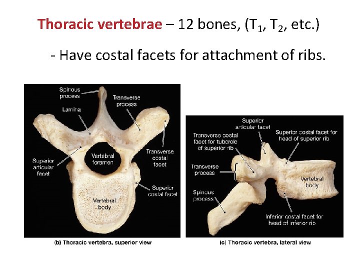 Thoracic vertebrae – 12 bones, (T 1, T 2, etc. ) - Have costal