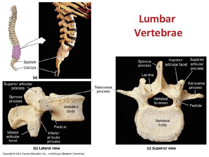 Lumbar Vertebrae 