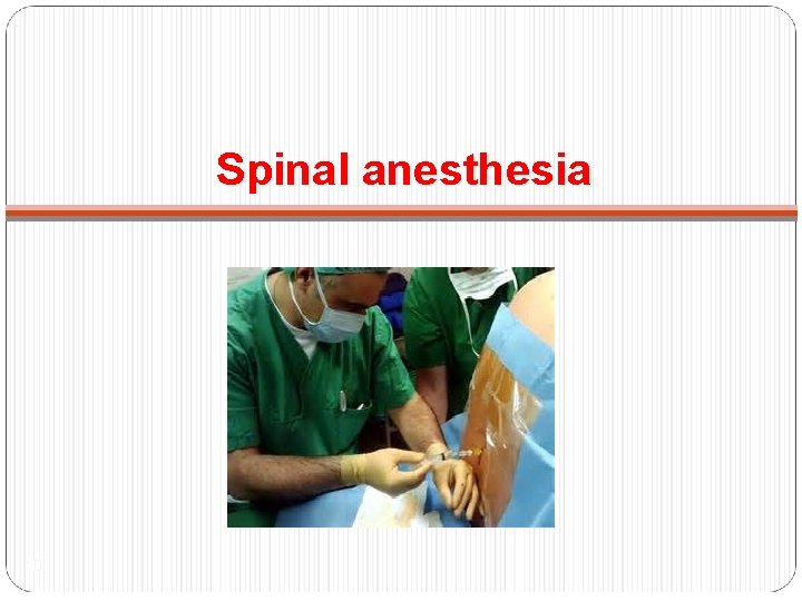 Spinal anesthesia 10 
