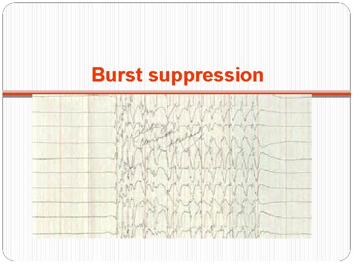 Burst suppression 16 
