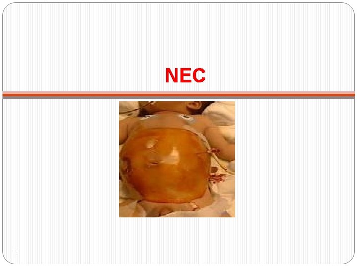 NEC 19 