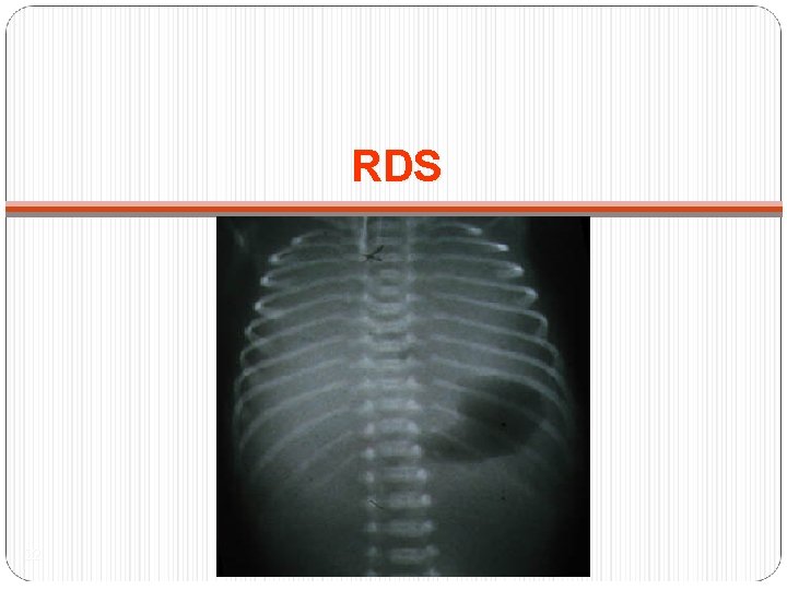 RDS 22 