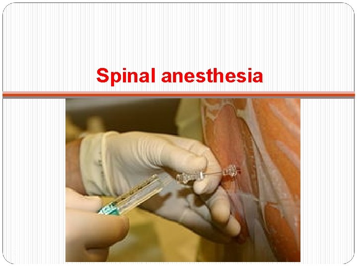 Spinal anesthesia 4 