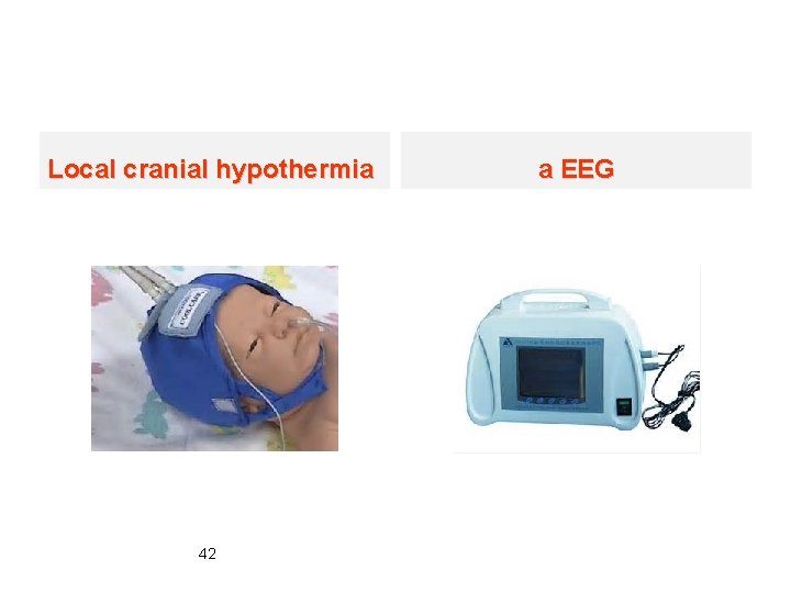 Local cranial hypothermia 42 a EEG 