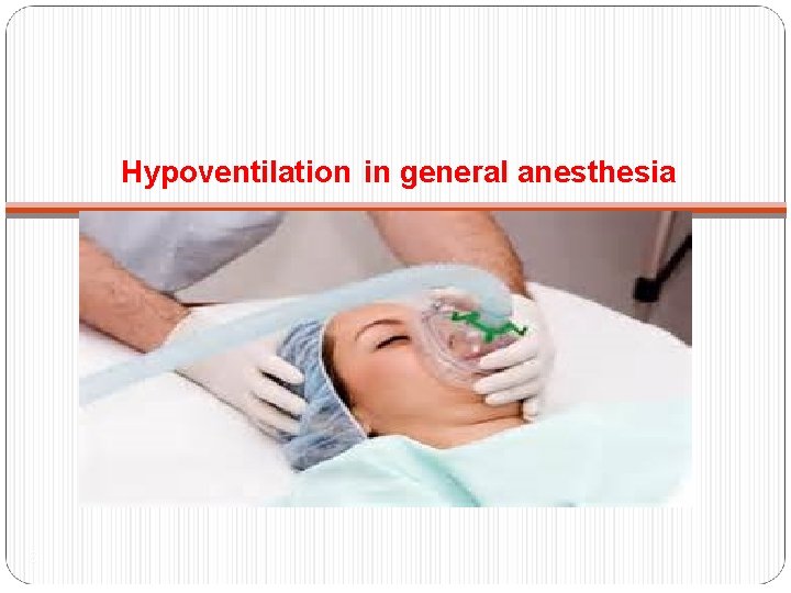 Hypoventilation in general anesthesia 6 