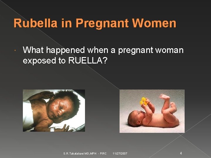 Rubella in Pregnant Women What happened when a pregnant woman exposed to RUELLA? S.