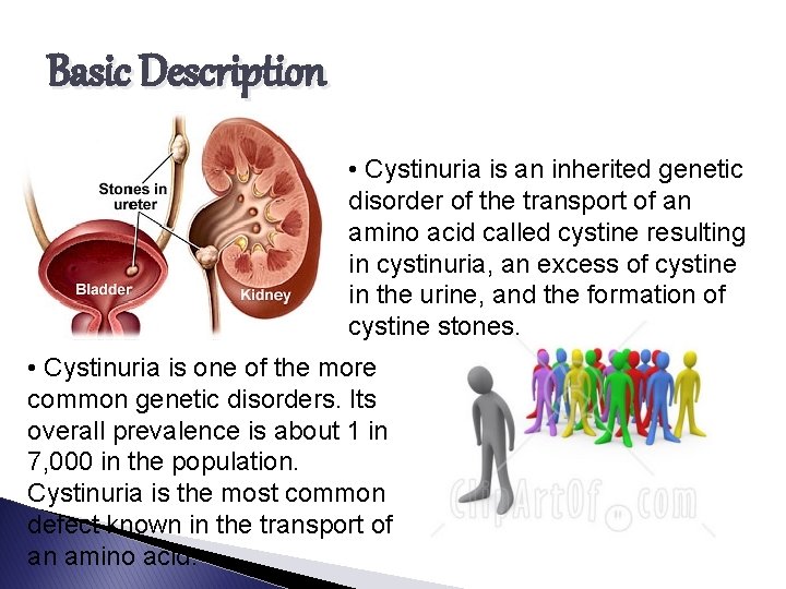 Basic Description • Cystinuria is an inherited genetic disorder of the transport of an