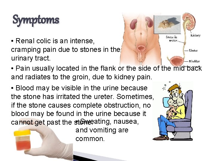 Symptoms • Renal colic is an intense, cramping pain due to stones in the