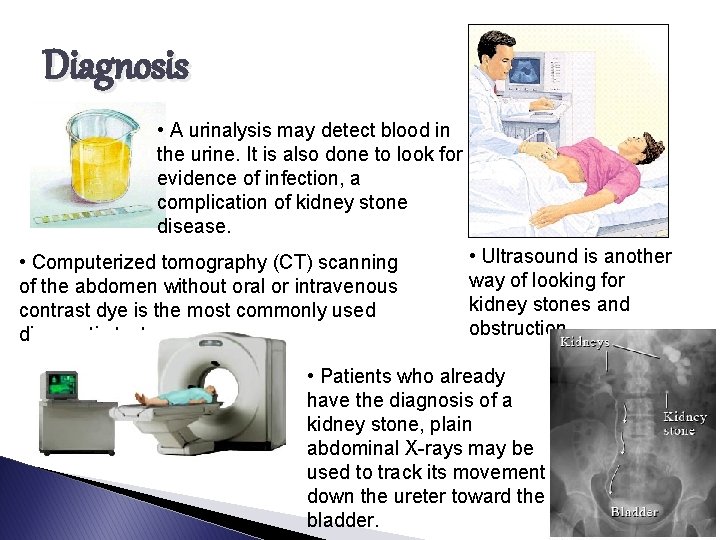Diagnosis • A urinalysis may detect blood in the urine. It is also done