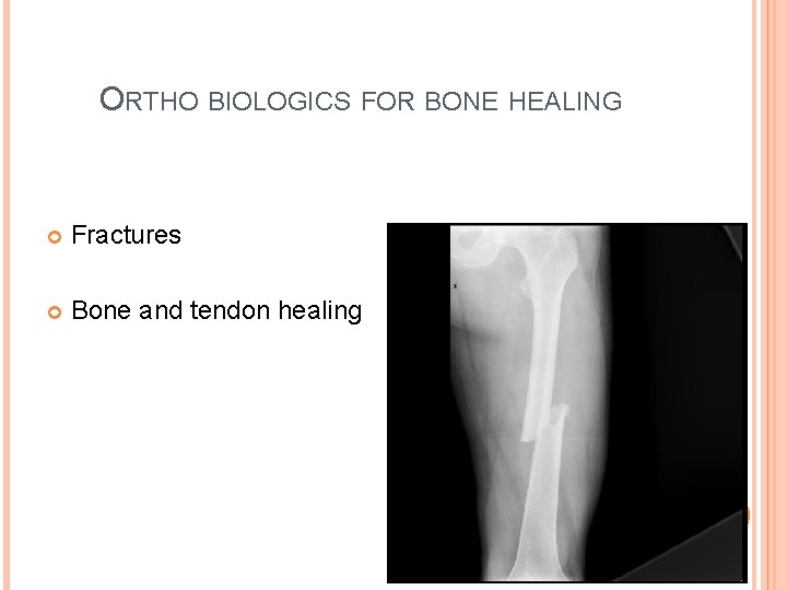 ORTHO BIOLOGICS FOR BONE HEALING Fractures Bone and tendon healing 