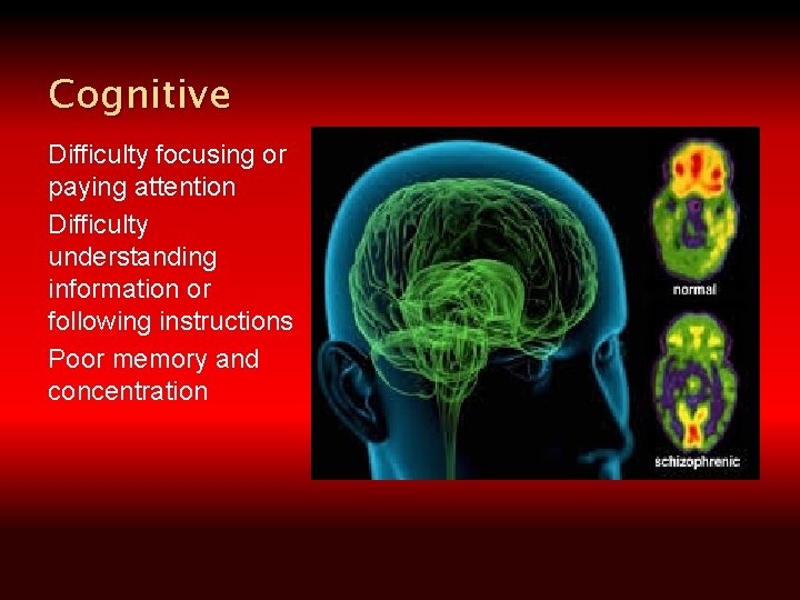 Cognitive Difficulty focusing or paying attention Difficulty understanding information or following instructions Poor memory