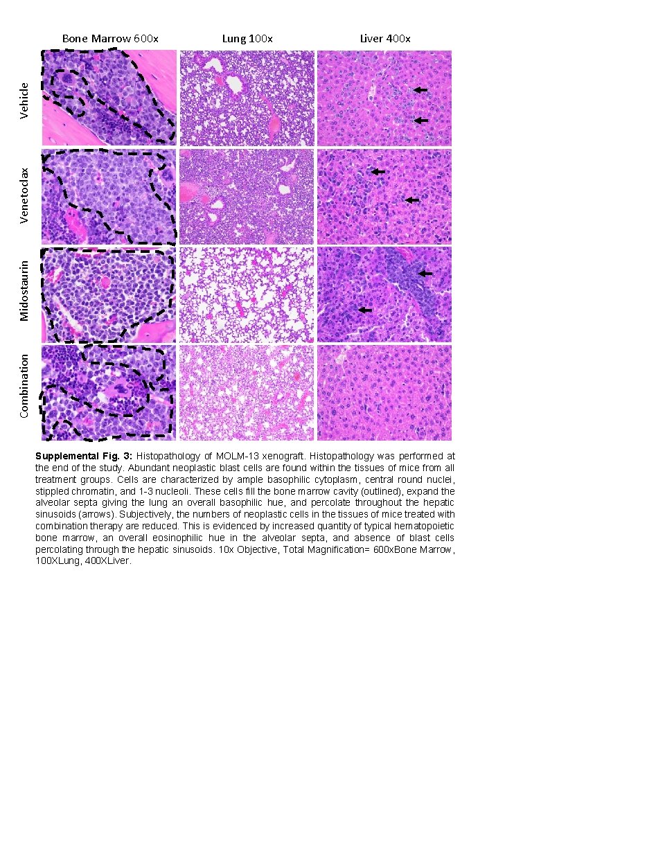 Lung 100 x Liver 400 x Combination Midostaurin Venetoclax Vehicle Bone Marrow 600 x