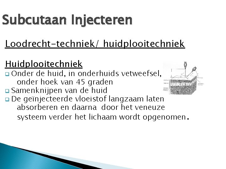 Subcutaan Injecteren Loodrecht-techniek/ huidplooitechniek Huidplooitechniek Onder de huid, in onderhuids vetweefsel, onder hoek van