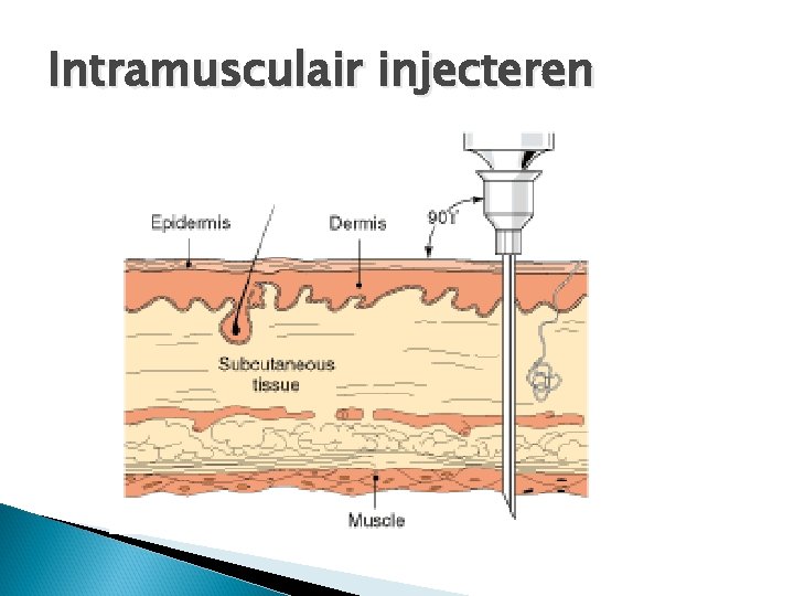 Intramusculair injecteren 