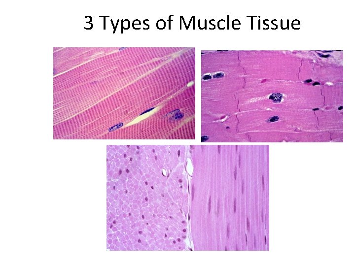 3 Types of Muscle Tissue 