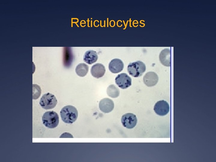 Reticulocytes 