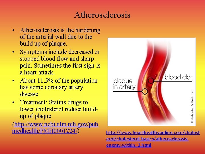 Atherosclerosis • Atherosclerosis is the hardening of the arterial wall due to the build