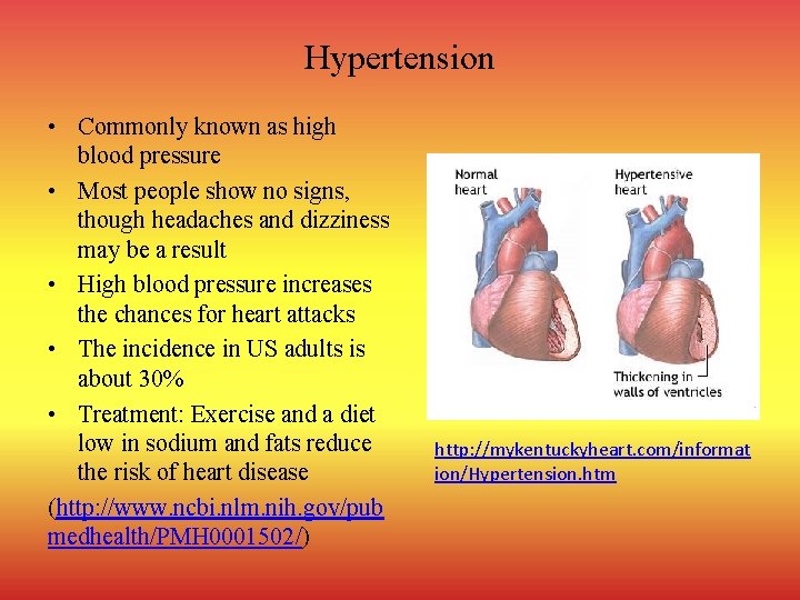 Hypertension • Commonly known as high blood pressure • Most people show no signs,