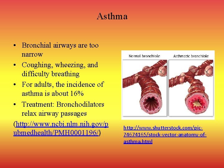Asthma • Bronchial airways are too narrow • Coughing, wheezing, and difficulty breathing •