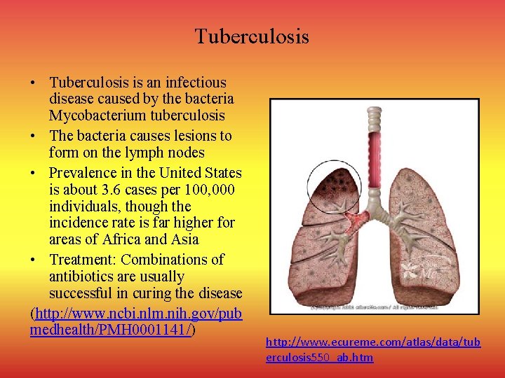 Tuberculosis • Tuberculosis is an infectious disease caused by the bacteria Mycobacterium tuberculosis •
