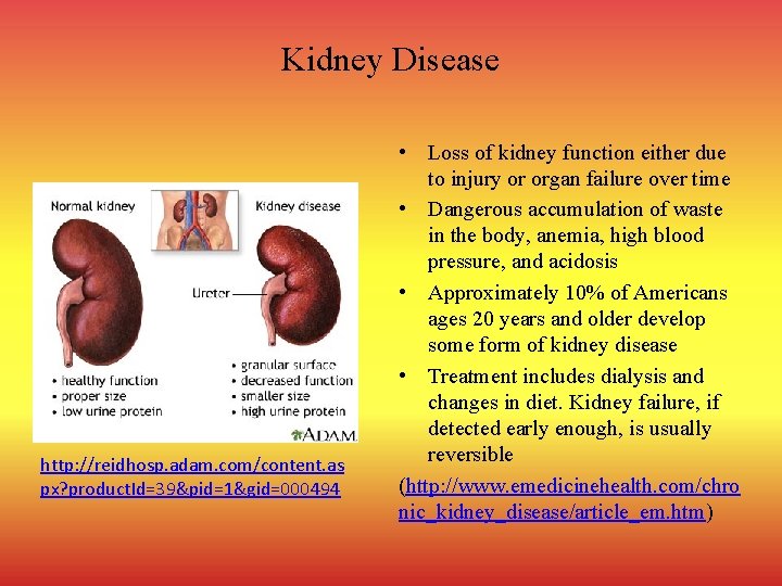 Kidney Disease http: //reidhosp. adam. com/content. as px? product. Id=39&pid=1&gid=000494 • Loss of kidney