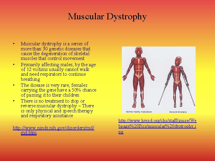 Muscular Dystrophy • • Muscular dystrophy is a series of more than 30 genetic