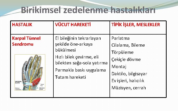 Birikimsel zedelenme hastalıkları HASTALIK VÜCUT HAREKETİ TİPİK İŞLER, MESLEKLER Karpal Tünnel Sendromu El bileğinin