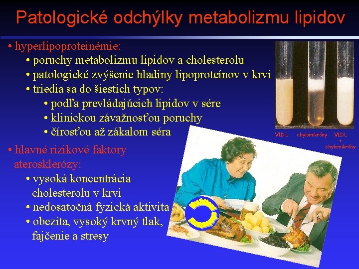 Patologické odchýlky metabolizmu lipidov • hyperlipoproteinémie: • poruchy metabolizmu lipidov a cholesterolu • patologické